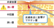 脂肪吸引後に皮膚がよれよれになってしまう原因