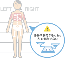 脂肪吸引で左右差が出てしまう原因