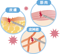脂肪吸引後にしびれが消えない原因