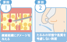 脂肪吸引で皮膚がたるむ原因