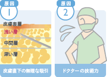 脂肪吸引で溝ができる原因